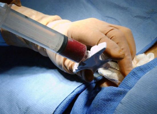 Bone Marrow Aspirate Concentrate (BMAC) Injections
