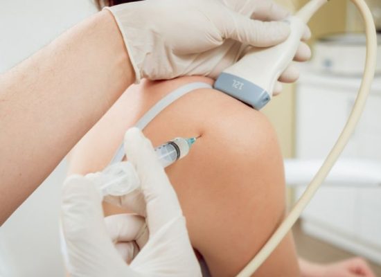 Platelet rich plasma (PRP)