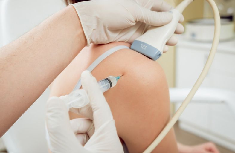 Platelet rich plasma (PRP)